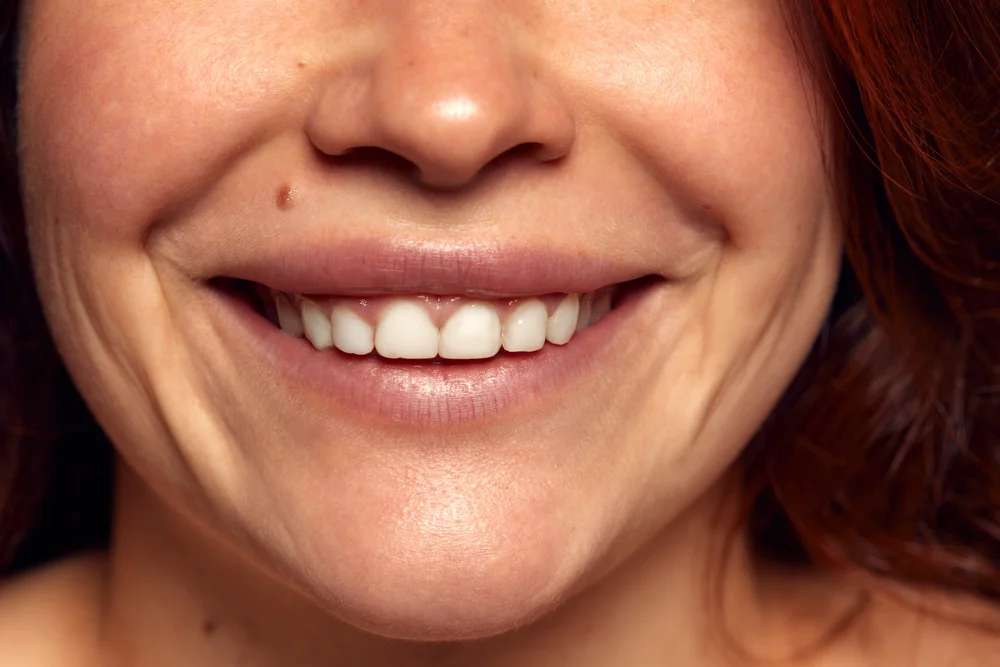 dental insurance